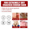 Exfoliating Feet Mask Sock Exfoliation Scrub for Feet Mask Remove Dead Skin Moisturizing Pedicure Anti Crack Foot Patch Spa 5PCS.