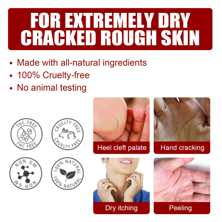 Exfoliating%20Feet%20Mask%20Sock%20Exfoliation%20Scrub%20for%20Feet%20Mask%20Remove%20Dead%20Skin%20Moisturizing%20Pedicure%20Anti%20Crack%20Foot%20Patch%20Spa%205PCS%20-%20Image%203