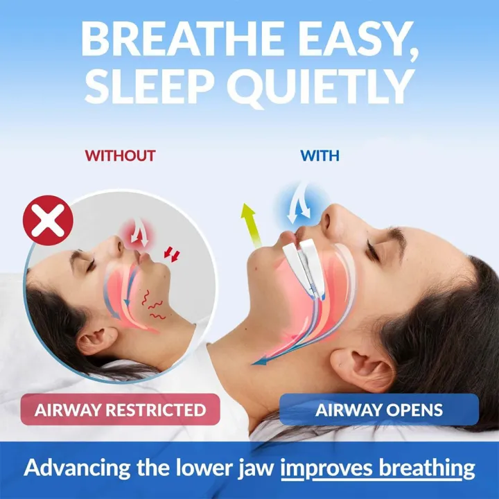 Anti-Snoring%20Mouthpiece%20Anti-Snoring%20Device%20Night%20Time%20Teeth%20Mouthguard%20Adjustable%20Sleeping%20Mouth%20Guard%20for%20Bruxism%20Stop%20Snoring%20-%20Image%205