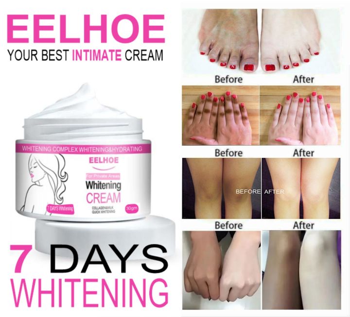 Whitening Cream for Women - Best for Women
