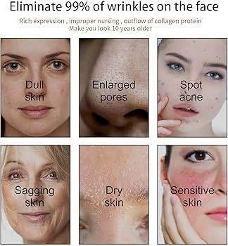 The%20Ordinary%20-%20100%25%20Organic%20Cold-Pressed%20Rose%20Hip%20Seed%20Oil(Null)%20-%20Image%203