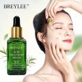BREYLEE Tea Tree Clear Skin Serum for Clearing Severe Acne, Breakout, Remover Pimple and Repair Skin -17ml. 