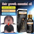 Hair Growth Essential Oil Biotin & DHT Blocker for Anti Hair loss and Repair Hair Growth Oil 30ml. 