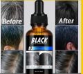 Black Hair Serum For Men & Women Anti Hair Fall,Hair Growth 30 Ml. 