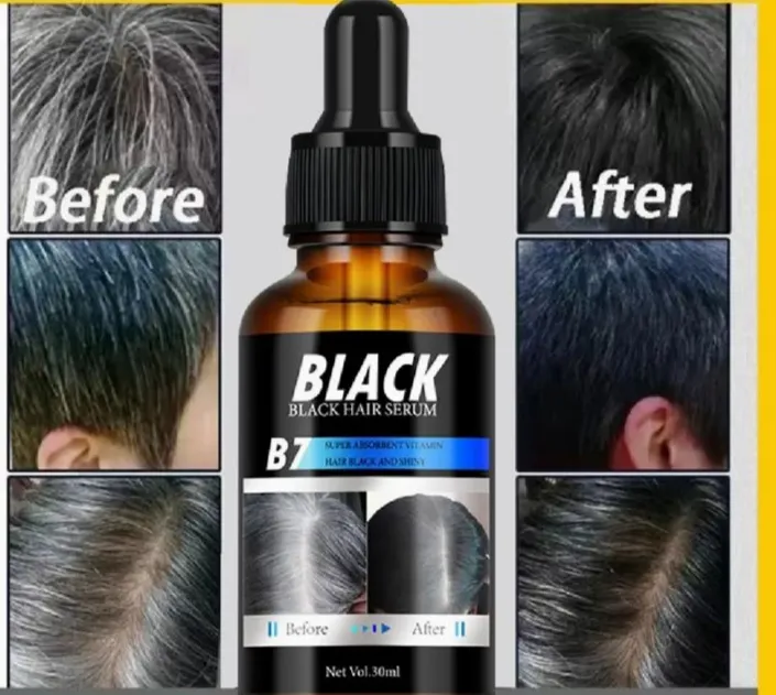 Black%20Hair%20Serum%20For%20Men%20&%20Women%20Anti%20Hair%20Fall,Hair%20Growth%2030%20Ml%20-%20Image%207