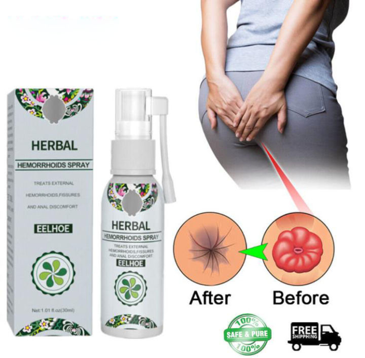30ML EELHOE HERBAL Hemorrhoids Spray Soothes Hemorrhoids Hemorrhoids Treat Shrink Hemorrhoid Spray