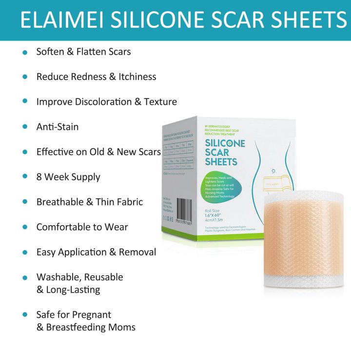 4cmx150cm%20Silicone%20Scar%20Sheets%20Removal%20Strips%20Silicone%20Gel%20Scar%20Strip%20For%20Acne%20Keloid%20Surgery%20Burn%20Treatment%20Scar%20Patch%20Hot%20Sale%20-%20Image%202