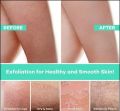 Body Dead Skin Removing Exfoliating Bath Glove Massage Cleaning Gloves. 