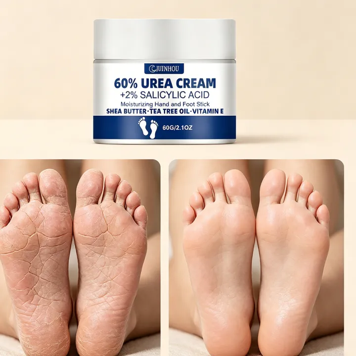 JUINHOU%2060%25Urea%20Foot%20Cream%20for%20Cracked%20Heels%20Dry%20Skin%20Intensive%20Moisturizing%20Treatment%20Callus%20Remover%20Smooth%20Skin%20Daily%20Foot%20Car%20-%20Image%203