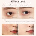 Sweet Mint Concealer, Tri-color Concealer Palette of Covers Acne Marks Dark Circles, 3 in 1 Face Foundation Cream, Tri-color Concealer with Brush, 3 in 1 Face Foundation Cream Waterproof. 