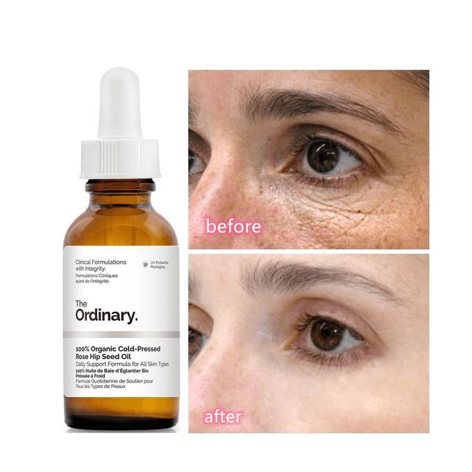 Caffeine Solution 5% + EGCG, Depuffing Eye Serum for Dark Circles and Tired Eyes