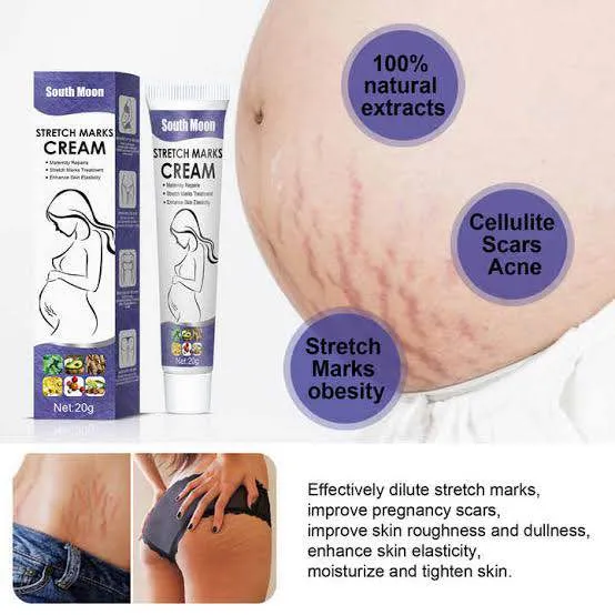 South%20Moon%20Effective%20Body%20Stretch%20Marks%20Removal%20Cream%20Lotion%20Pregnancy%20Stretch%20Mark%20Cream%20for%20Fair%20Skin%20Repair%20Cream%2020g%20-%20Image%202