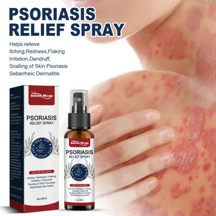 South%20Moon%20Psoriasis%20Relief%20Spray%20Net:%2030ml%20-%20Image%204