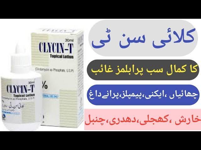 Clycin-T%20Lotion%2030ml%20-%20Image%203