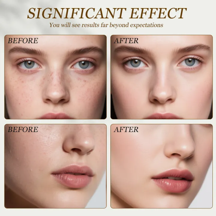 Peptide%20Gold%20Ampoule%20Skin%20Booster%20Crosslinked%20Hyaluronic%20Acid%20Facial%20Essence%20%20Moisturize%20Rejuvenating%20Skin%20Care%20New%20-%20Image%204