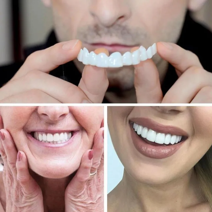 1%20pair%20Teeth%20Veneers%20Men%20Women%20Brightening%20Dentures%20Temporary%20False%20Teeth%20Cover%20Instant%20Imitation%20Braces%20For%20Confidence%20Smile%20-%20Image%202
