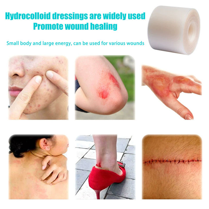 1Pcs%20Hydrocolloid%20Roll%20For%20Wound%20Care%20Hydrocolloid%20Patch%20Bandages%20With%20Self-Adhesive%20Bed%20Sore%20Bandages%20Highly%20Absorbent%20For%20Burn%20-%20Image%206