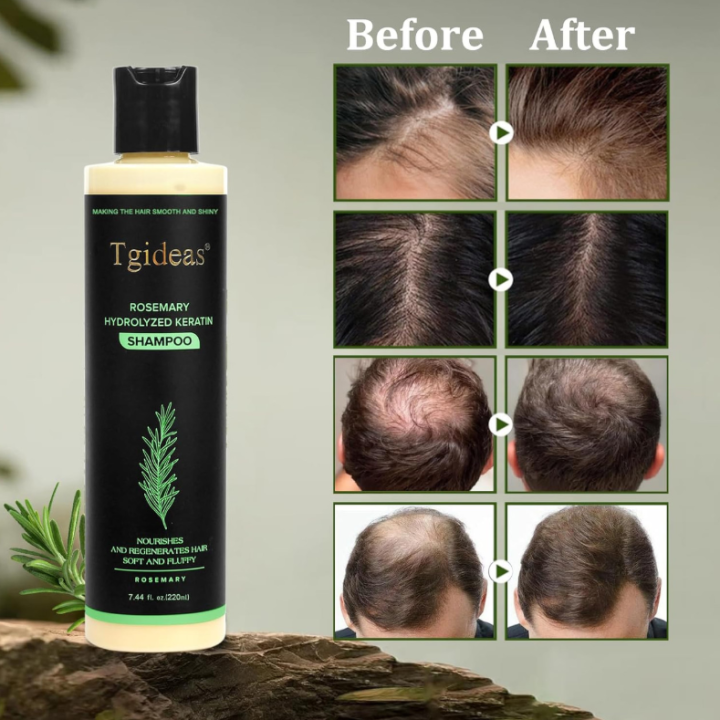 Tgideas%20Organic%20Rosemary%20Hair%20Growth%20Shampoo%20Hydrolyzed%20Keratin%20Nourish%20Scalp%20Reduce%20Loss%20Unisex%20Shampoo%20For%20Dry%20Fragile%20Hair%20-%20Image%203