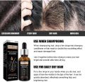 Hair Growth Essential Oil Biotin & DHT Blocker for Anti Hair loss and Repair Hair Growth Oil 30ml. 