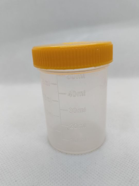 Urine Container non-Sterilized 60ml (Pack of 50)