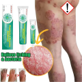 Jemeesen Psoriasis Medicated Treatment Cream. 