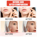 144pcs/set Face Skin Care Acne Pimple Patch Invisible Professional Healing Absorbing Spot Sticker Covering Acne for Men Women. 