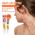 Professional Skin Care Cream Expert Skin Fighter for Psoriasis and Dermatitis for Healthy Skin 15g. 
