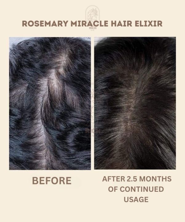 Rosemary Hair Elixir Spray, Rosemary hair, No More hair fall Elixir, Hair Growth tonic, Organic Hair growth