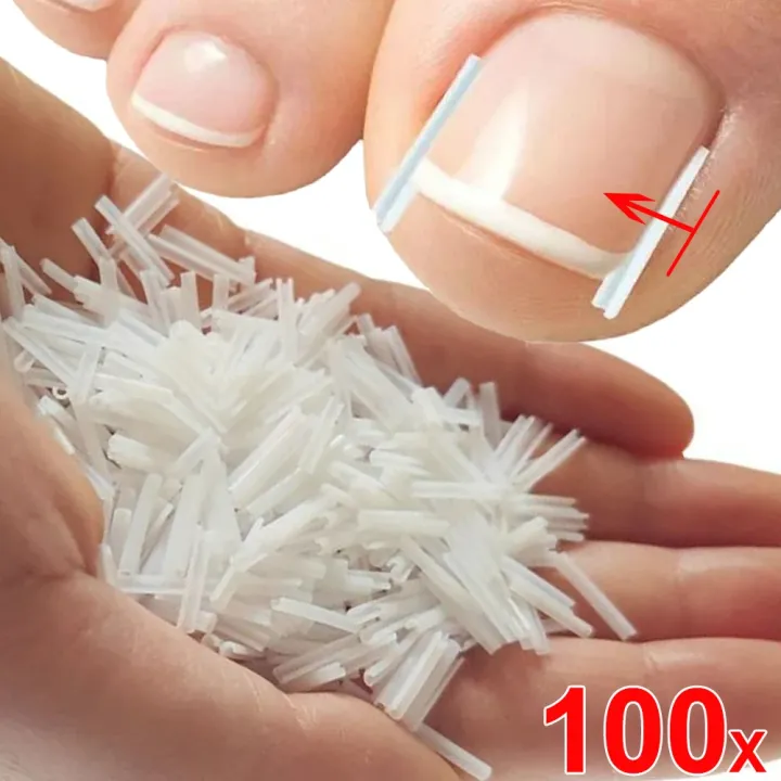 1-100PCS%20Ingrown%20Toenail%20Correction%20Ultra-thin%20Nail%20Treatment%20Elastic%20Patch%20Sticker%20Straightening%20Nails%20Groove%20Ingrown%20Corrector%20-%20Image%203