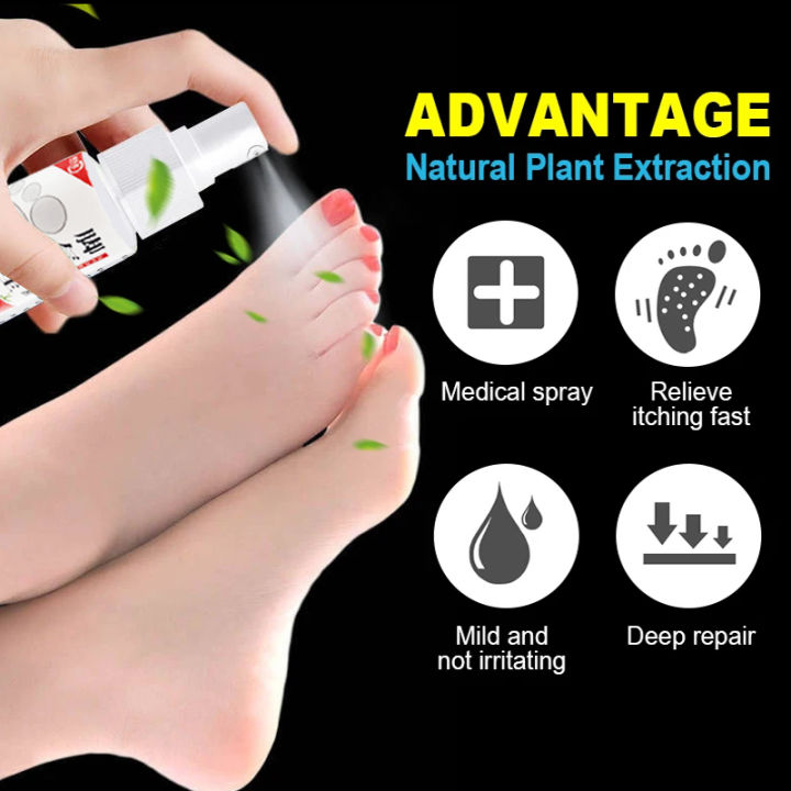 1Pcs%20Anti%20Fungal%20Foot%20Spray%20Foot%20Odor%20Remover%20Athlete%20Foot%20Medical%20Liquid%20Eczema%20Itching%20Onychomycosis%20Treatment%20Foot%20Care%20freshfeet%20-%20Image%203