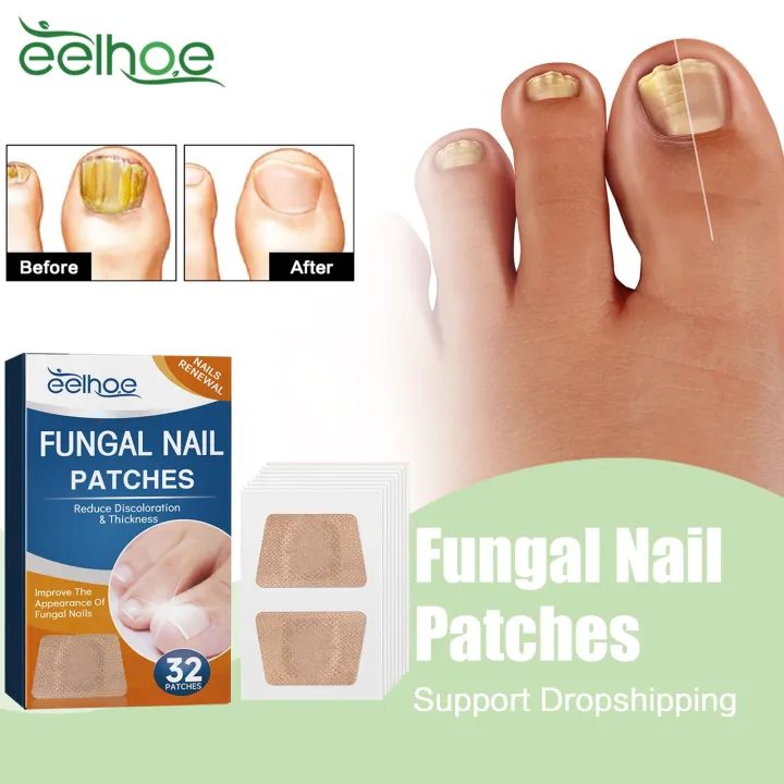 Patch Traitement Antifongique Pour Ongles - Soin Onychomycose, Neuf