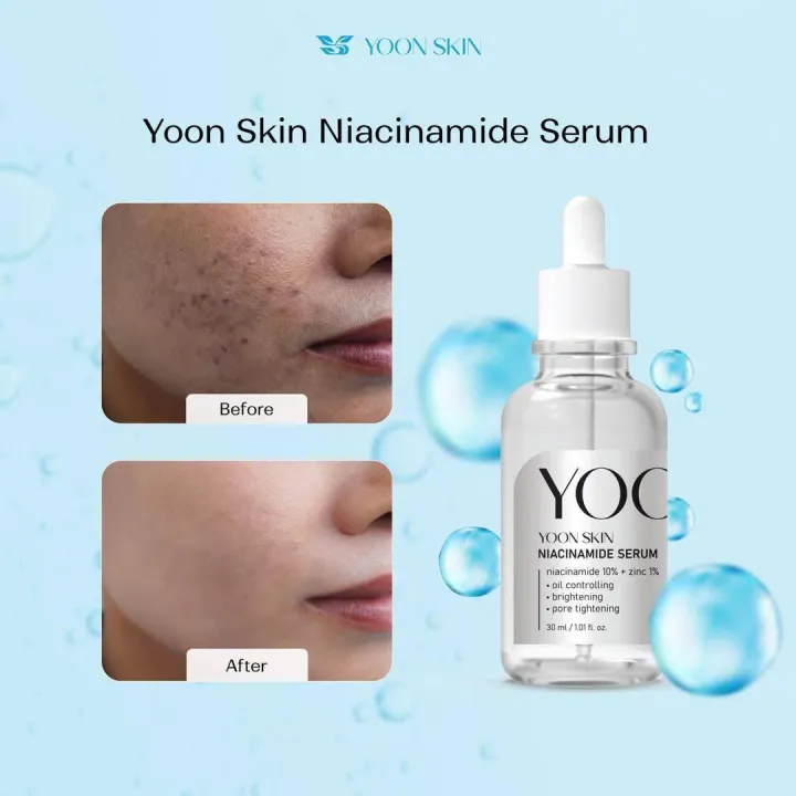 Yoon%20Skin%20Niacinamide%20+%20Zinc%20Serum%20%7B%2030ml%20%7D%20-%20Image%202