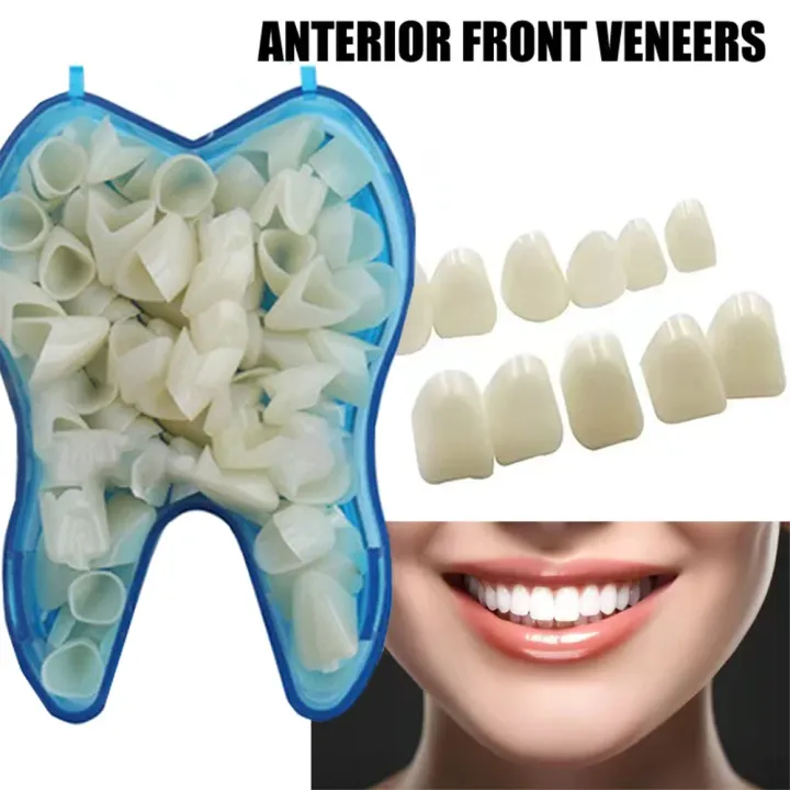 AG%2050%20Pcs/Box%20Dental%20Temporary%20Crown%20Kit%20Anterior%20Front%20Molar%20Posterior%20Teeth%20Veneers%20Dentistry%20Tooth%20%20Dental%20Tools%20-%20Image%202