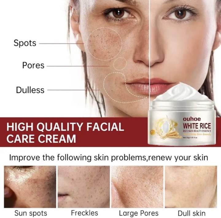 White%20Rice%20Face%20Whitening%20Cream%20Remove%20Dark%20Spots%20Fade%20Freckle%20Melanin%20Anti%20Wrinkle%20Aging%20Moisturizing%20Brighten%20Skin%20Care%20-%20Image%202