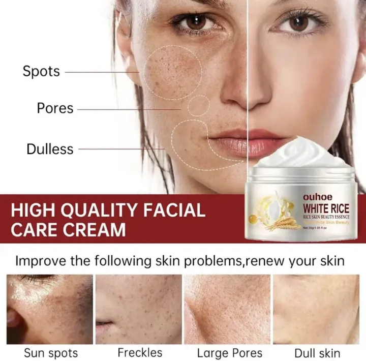 White%20Rice%20Face%20Whitening%20Cream%20Remove%20Dark%20Spots%20Fade%20Freckle%20Melanin%20Anti%20Wrinkle%20Aging%20Moisturizing%20Brighten%20Skin%20Care%20-%20Image%202