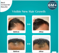Pilgrim 3% Redensyl + 4% Anagain Hair Growth Serum 30 ml. 