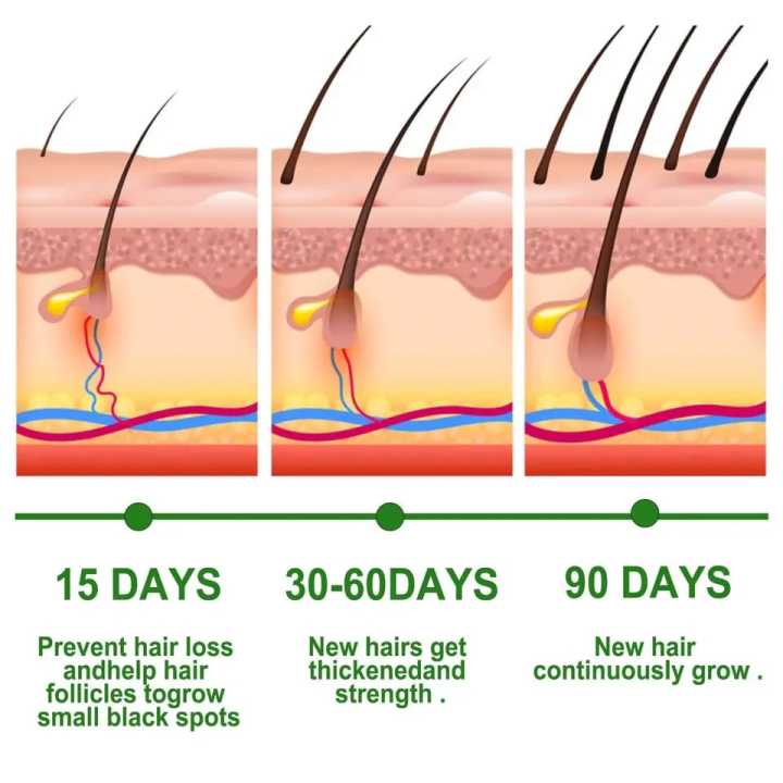 Rosemary%20Essential%20Oil%20Hair%20Growth%20Oils%20Pure%20Natural%2030ML%20Hair%20Essential%20Oils%20For%20Nourish%20Shiny%20Hair%20Healthy%20Hair%20Care%20-%20Image%203