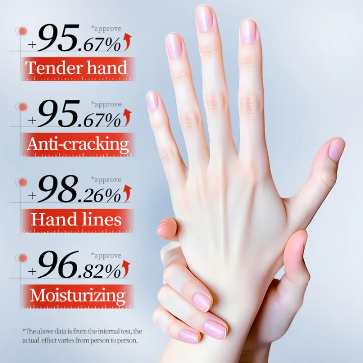 3/5pcs%20SADOER%2010%25%20Urea%20Anti-Cracking%20Hand%20Cream%20Panthenol%20HA%20Deep%20Moisturizing%20Improve%20Dryness%20Repair%20Cracked%20Hands%20Skincare%2030g%20-%20Image%204