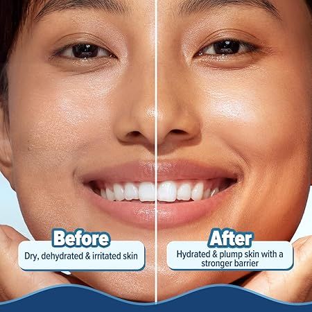 Aqualogica%20Barrier+%20Hydra%20Gel%20Moisturizer%20200%20gm%20-%20Image%206