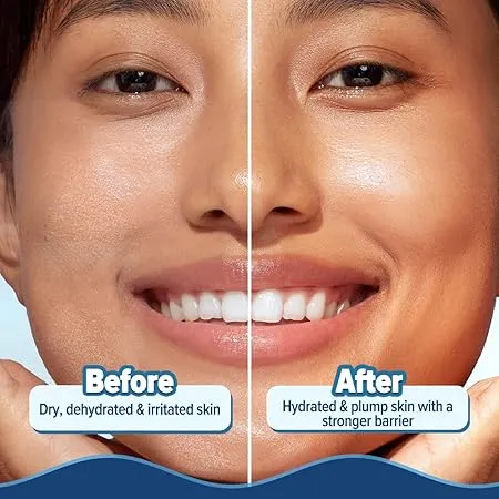 Aqualogica%20Barrier+%20Hydra%20Gel%20Moisturizer%20200%20gm%20-%20Image%206