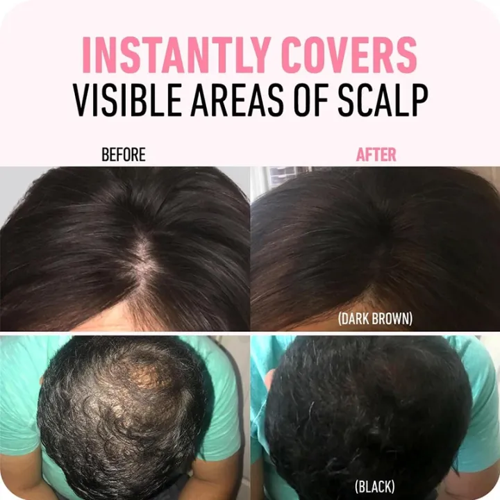 Hair%20Line%20Powder%204g%20Black%20Root%20Cover%20Up%20Natural%20Instant%20Waterproof%20Hairline%20Shadow%20Powder%20Hair%20Concealer%20Coverage%2014%20color%20staloofy%20hair%20-%20Image%206