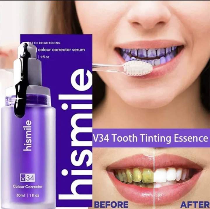 Original Hismile V34 Teeth Whitening | Hismile Teeth Whitening Serum ...