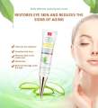 AICHUN BEAUTY Dark Eye Circles Wrinkles Cream Natural Moisturizing Aloe Vera 30g. 