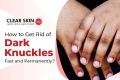 Dark Knuckle Whitening Serum. 