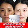 377 Whitening Spot Removal Cream 50 GM. 
