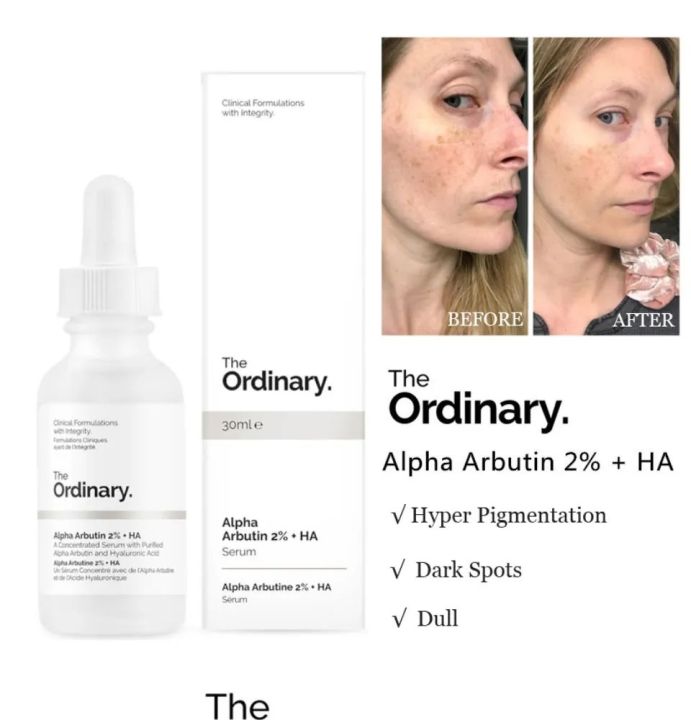 The Ordinary Alpha Arbutin 2% + HA 30ml | Daraz.lk