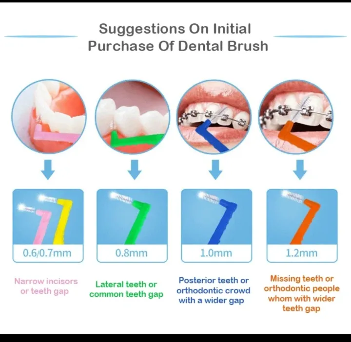 Medical%20cleaning%20interdental%20brush%20L-shaped%20interdental%20brush%20ultra-fine%20soft%20hair%20orthodontic%20special%20disposable%20bracket%20gap%20cleaning%20interdental%20brush%20-%20Image%204