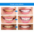 1-5PCS 4ml Teeth Pen Effective Painless Gum Therapy Gel Teeth Essence Pen No Sensitivity Teeth Gel.