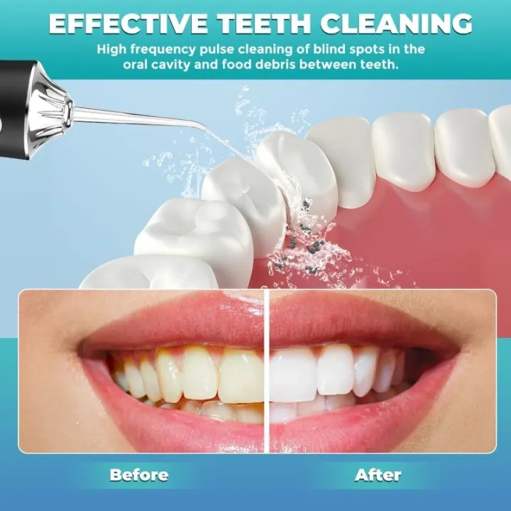 Oral%20Irrigator%20Portable%20USB%20Rechargeable%20Dental%20Water%20Flosser%20Water%20Jet%20Floss%20Tooth%20Pick%204%20Jet%20Tip%20220ml%203%20Modes%20IPX7%20Waterproof%20-%20Image%203