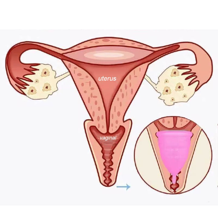2Pcs%20Women%20Menstrual%20Cup%20Medical%20Silicone%20Vaginal%20Cups%20Reusable%20Menstrual%20Bowl%20Feminine%20Hygiene%20cup%20for%20Menstruation%20Collection%20-%20Image%206